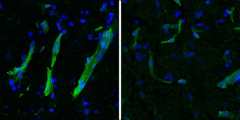Researchers studying ALS and FTLD in human brain samples saw many similarities at the cellular and molecular level. Here, stained motor cortex tissue from a donor with ALS (right) shows reduced amounts of the protein HLA-E (green) in blood vessels. HLA-E is thought to inhibit degradation of the blood brain barrier by the immune system. Researchers found reduced expression of HLA-E in both ALS and FTLD (Credits: Courtesy of the Heiman Lab/Picower Institute).