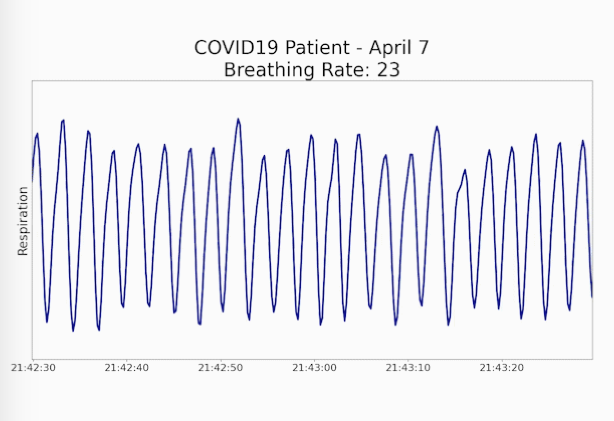 COVID-19 breathing