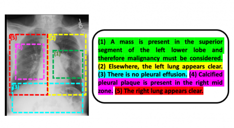 Chest X-ray